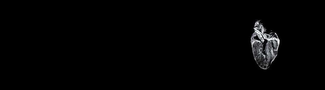 Sky Burial, Snapshots